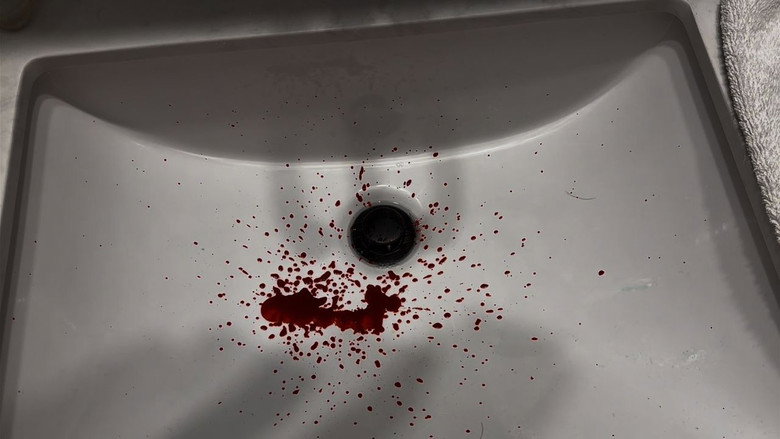 Bloody Nose backdrop