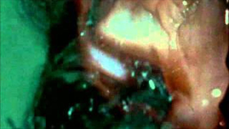 Scene 4